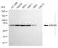 KD-Validated Anti-HADHA Mouse Monoclonal Antibody